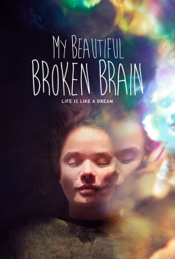 My Beautiful Broken Brain